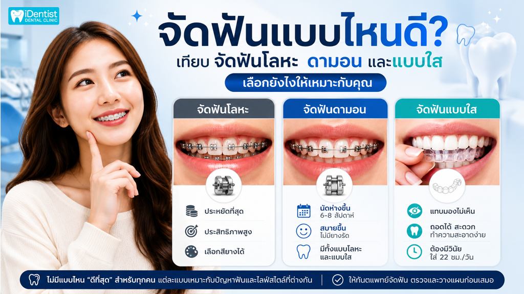 จัดฟันแบบไหนดี