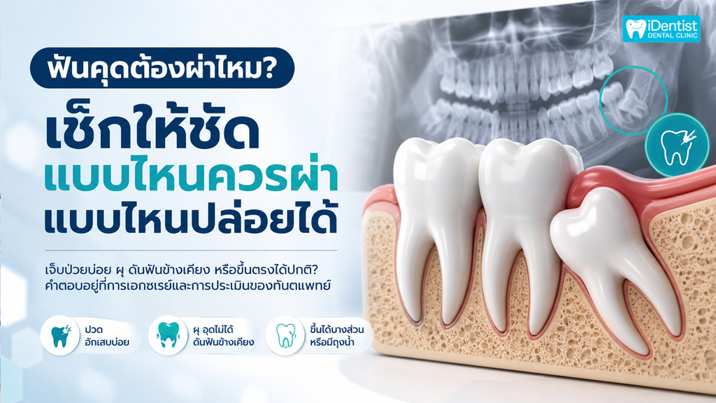 ฟันคุดต้องผ่าไหม