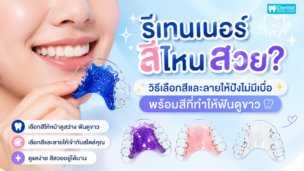 รีเทนเนอร์สี