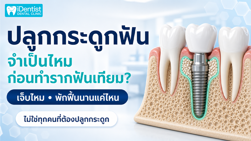 ปลูกกระดูกก่อนรากฟันเทียม
