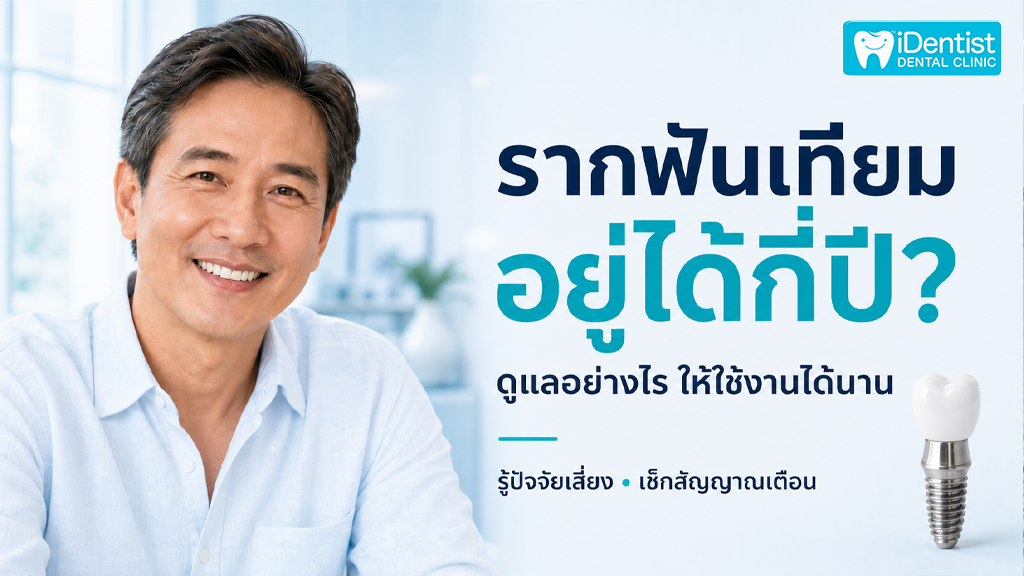รากฟันเทียมอยู่ได้กี่ปี + ดูแล